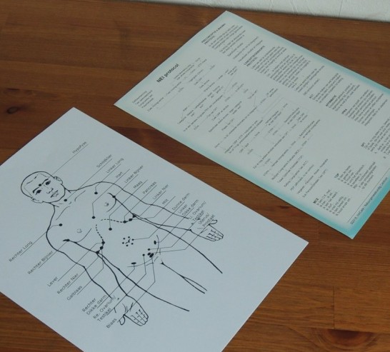 Orgaan Reflex Punten